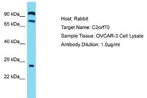 Host: Rabbit Target Name: C2ORF70 Sample Tissue: Human OVCAR-3 Whole Cell Antibody Dilution: 1ug/ml (C2ORF70 antibody  (C-Term))