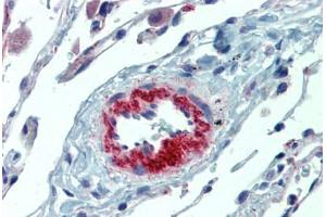 Lung, vasculature, Human: Formalin-Fixed, Paraffin-Embedded (FFPE) (IL23A antibody)