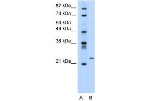 Transfected 293T; WB Suggested Anti-PMF1 Antibody Titration: 0. (PMF1 antibody  (Middle Region))