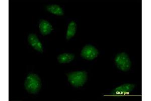 Immunofluorescence of purified MaxPab rabbit antibody to IL16 on HeLa cell. (IL16 antibody  (AA 1-454))