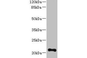Western blot All lanes: TTC9C antibody at 12 μg/mL + THP-1 whole cell lysate Secondary Goat polyclonal to rabbit IgG at 1/10000 dilution Predicted band size: 21, 25 kDa Observed band size: 21 kDa (TTC9C antibody  (AA 1-171))