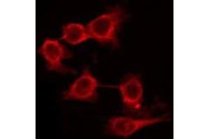 ABIN6266551 staining HuvEc by IF/ICC. (GRM7 antibody  (C-Term))
