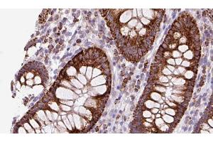 ABIN6272883 at 1/100 staining Mouse colon tissue by IHC-P. (TMEM67 antibody  (Internal Region))