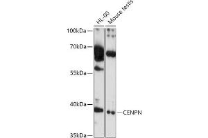 Western blot analysis of extracts of various cell lines, using CENPN antibody (ABIN7266276) at 1:1000 dilution. (CENPN antibody  (AA 180-300))