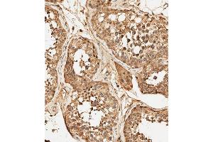 (ABIN392786 and ABIN2842224) staining PFKFB4 in human testis tissue sections by Immunohistochemistry (IHC-P - paraformaldehyde-fixed, paraffin-embedded sections). (PFKFB4 antibody  (AA 266-296))