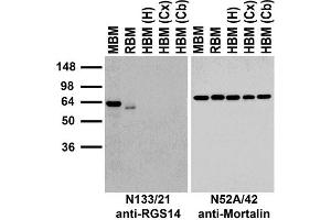 Immunoblot against crude membranes from whole mouse (MBM) or rat (RBM) brain and from human hippocampus [HBM(H)], cerebral cortex [HBM(Cx)] or cerebellum [HBM(Cb)] probed with N133/21 (left) or N52A/42 (right) TC supe. (RGS14 antibody  (AA 1-544))