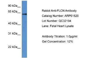 Western Blotting (WB) image for anti-Folliculin (FLCN) (N-Term) antibody (ABIN2788829) (FLCN antibody  (N-Term))