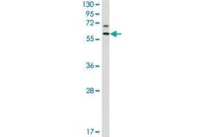 Western blot analysis of MMP17 polyclonal antibody  in NCI-H460 cell lysate (35 ug/lane). (MMP17 antibody  (Internal Region))