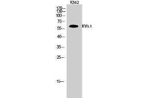 Western Blotting (WB) image for anti-Potassium Voltage-Gated Channel, Shaw-Related Subfamily, Member 1 (KCNC1) (Internal Region) antibody (ABIN3185333) (KCNC1 antibody  (Internal Region))