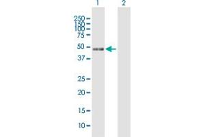 Western Blot analysis of RP5-1077B9. (MIIP antibody  (AA 1-388))