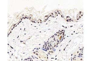 Immunohistochemistry analysis of paraffin-embedded mouse skin using MGMT Polyclonal Antibody at dilution of 1:300. (MGMT antibody)