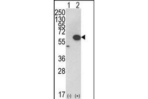 Western blot analysis of AKT1 (arrow) using rabbit polyclonal hAKT1- (ABIN652283 and ABIN2841190). (AKT1 antibody  (C-Term))