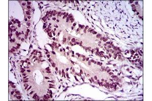Immunohistochemistry (IHC) image for anti-E2F Transcription Factor 1 (E2F1) (AA 69-223) antibody (ABIN969516)