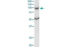 PKD2L1 monoclonal antibody (M01), clone 4F9. (PKD2L1 antibody  (AA 173-272))