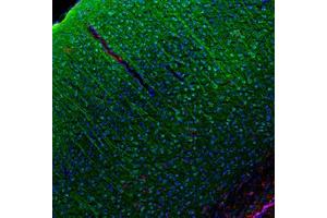 Image no. 1 for anti-Chemokine (C-C Motif) Ligand 5 (CCL5) antibody (ABIN465617) (CCL5 antibody)