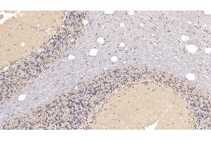Detection of SIGLEC10 in Human Cerebellum Tissue using Monoclonal Antibody to Sialic Acid Binding Ig Like Lectin 10 (SIGLEC10) (SIGLEC10 antibody  (AA 571-697))