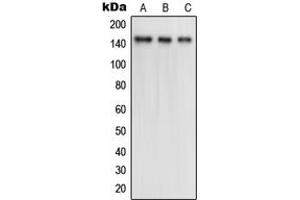 Western blot analysis of TRK B (pY516) expression in HL60 (A), SKNSH (B), mouse brain (C) whole cell lysates. (TRKB antibody  (pTyr516))