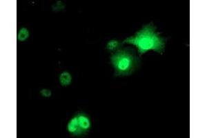 Anti-AP2M1 mouse monoclonal antibody (ABIN2454656) immunofluorescent staining of COS7 cells transiently transfected by pCMV6-ENTRY AP2M1 (RC201377). (AP2M1 antibody  (AA 97-383))