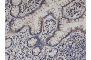 Immunoperoxidase of monoclonal antibody to KIF1C on formalin-fixed paraffin-embedded human small Intestine. (KIF1C antibody  (AA 1004-1103))