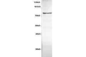 Western Blot analysis of HeLa cells using Cadherin-8 Polyclonal Antibody at dilution of 1:600 (Cadherin 8 antibody)