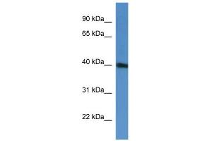 WB Suggested Anti-PRPF38A Antibody Titration: 0. (PRPF38A antibody  (C-Term))