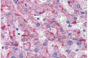 Human Liver: Formalin-Fixed, Paraffin-Embedded (FFPE) (SORBS1 antibody  (AA 300-313))