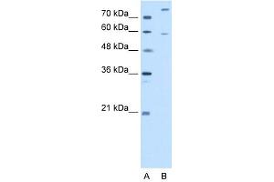 WB Suggested Anti-CROT Antibody Titration:  2. (CROT antibody  (N-Term))