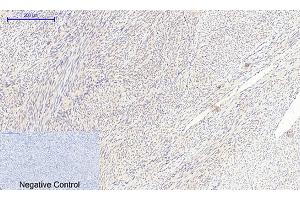 Immunohistochemical analysis of paraffin-embedded human uterus tissue.