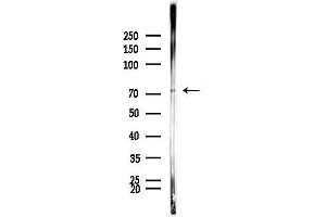 anti-RAS Guanyl Releasing Protein 4 (RASGRP4) antibody
