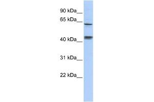 WB Suggested Anti-KLHL8 Antibody Titration:  0. (KLHL8 antibody  (Middle Region))