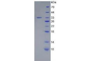 SDS-PAGE analysis of Human Laminin gamma 1 Protein.