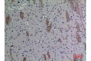 Immunohistochemistry (IHC) analysis of paraffin-embedded Mouse Brain, antibody was diluted at 1:100. (CCL26 antibody  (Internal Region))