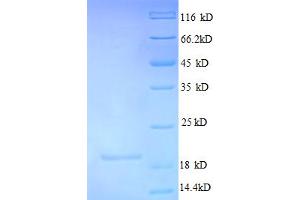 Chromosome 4 Open Reading Frame 3 (C4ORF3) (AA 1-44), (partial) protein (His-SUMO Tag)