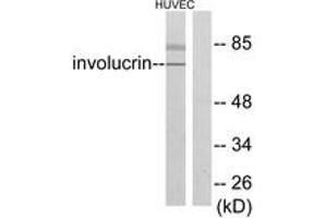 Western blot analysis of extracts from HuvEc cells, using Involucrin Antibody. (Involucrin antibody  (AA 536-585))