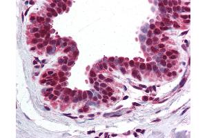 anti-Bromodomain Containing 2 (BRD2) (AA 524-573) antibody