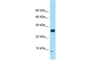 WB Suggested Anti-SPANXC Antibody Titration: 1. (SPANXC antibody  (N-Term))