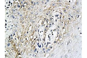 Antigen: 2 µg/100 µL  Primary: Antiserum, 1:500, 1:1000, 1:2000, 1:4000, 1:8000, 1:16000, 1:32000;  Secondary: HRP conjugated Rabbit Anti-Goat IgG at 1: 5000;  TMB staining  Read the data in Microplate Reader by 450nm. (IL-6 antibody  (AA 110-185))
