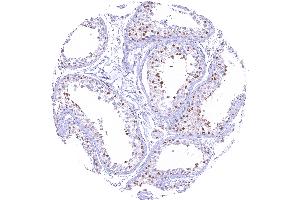 Testis with a distinct nuclear SMARCA2 staining in all intratubular cells except Sertoli cells