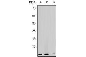 Western blot analysis of GHRH expression in Raji (A), HL60 (B), mouse liver (C) whole cell lysates. (GHRH antibody)
