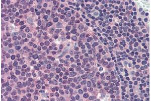 Human Tonsil (formalin-fixed, paraffin-embedded) stained with MCL1 antibody ABIN337283 at 10 ug/ml followed by biotinylated anti-mouse IgG secondary antibody ABIN481714, alkaline phosphatase-streptavidin and chromogen. (MCL-1 antibody)