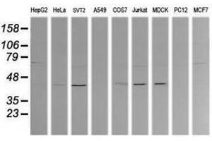 Image no. 1 for anti-Mitogen-Activated Protein Kinase Kinase 1 (MAP2K1) antibody (ABIN1499390) (MEK1 antibody)