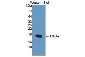 Western Blotting (WB) image for anti-Cartilage Oligomeric Matrix Protein (COMP) (AA 123-240) antibody (ABIN1867326) (COMP antibody  (AA 123-240))