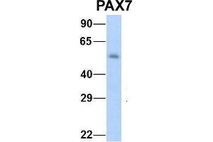 Host:  Rabbit  Target Name:  NOP56  Sample Type:  Human Fetal Muscle  Antibody Dilution:  1. (PAX7 antibody  (Middle Region))