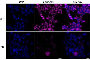 Immunocytochemical staining of HeLa cells using ARHGEF1 antibody (ABIN7800200), 1:1,000), Top panel: wild-type (WT), Bottom panal: ARHGEF1 shRNA knockdown (KD). (ARHGEF1 antibody)
