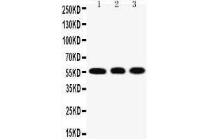 Anti-KLF4 antibody, Western blotting Lane 1: HELA Cell Lysate Lane 2: A549 Cell Lysate Lane 3: U20S Cell Lysate (KLF4 antibody  (N-Term))