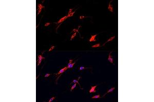 Immunofluorescence analysis of PC12 cells using ENO2 antibody. (ENO2/NSE antibody  (AA 195-434))