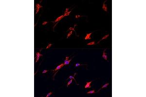 Immunofluorescence analysis of PC12 cells using ENO2 antibody. (ENO2/NSE antibody  (AA 195-434))