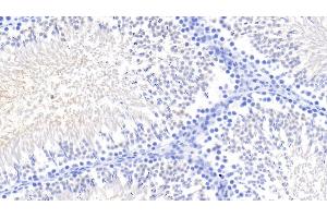 Detection of Kim1 in Rat Testis Tissue using Monoclonal Antibody to Kidney Injury Molecule 1 (Kim1) (HAVCR1 antibody  (AA 22-235))