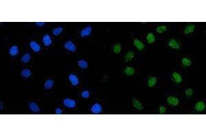 IF analysis of TRMT1 using anti-TRMT1 antibody (ABIN7602171). (TRMT1 antibody  (AA 61-626))