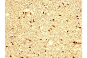 IHC image of ABIN7145183 diluted at 1:300 and staining in paraffin-embedded human brain tissue performed on a Leica BondTM system. (BDKRB2 antibody  (AA 336-391))